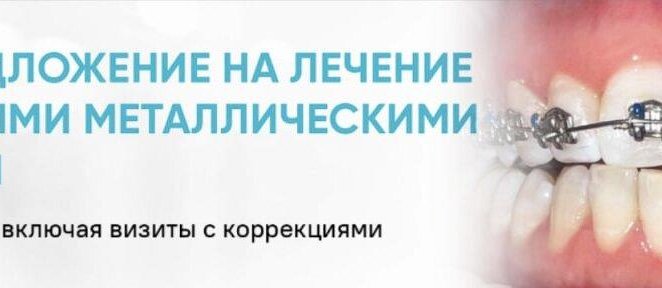 Специальное предложение на металлические брекеты