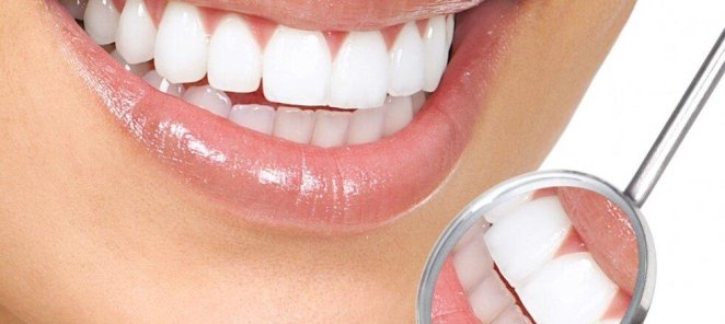Отбеливание зубов системой Amazing white всего 10000 рублей