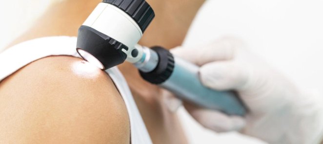 Диагностика новообразований кожи с консультацией за 2900 руб