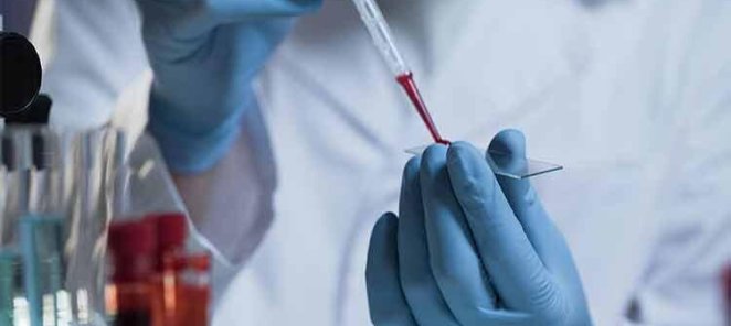 Скидка на все анализы крови 15% по кодовому слову.