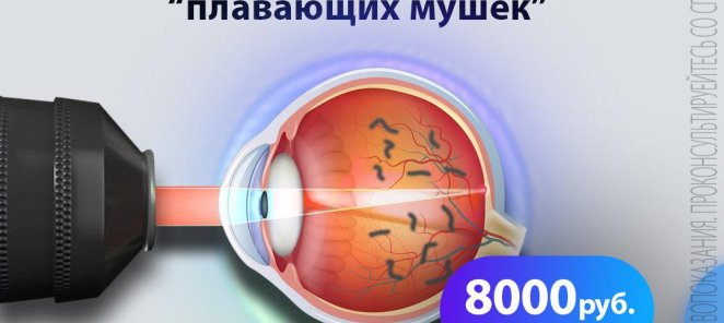 Удаление 