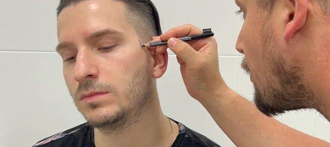 Бесплатная консультация по пересадке волос