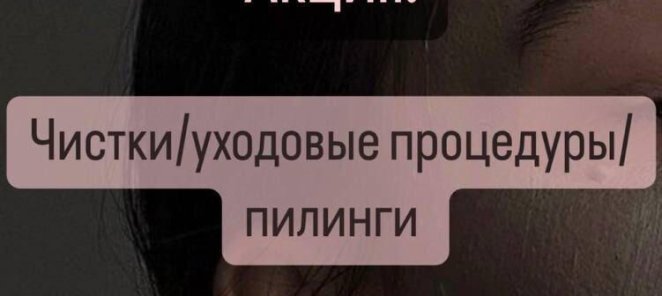 Акция!!! Чистки/ уходовые процедуры/ пилинги - 20%