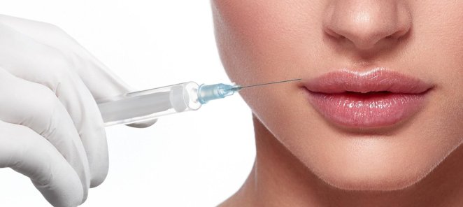 Акция по контурной пластике Full face 5ml-40000₽