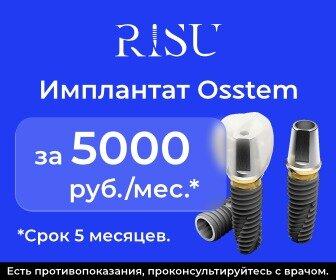 Импланты OSSTEM за 5000 руб./мес. + подарок!