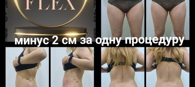 От - 2 см после первого сеанса - реальность!