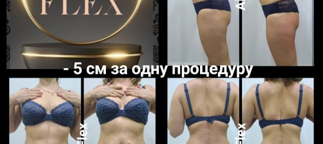 Air Flex после первой процедуры теряем от 2 см в объеме!