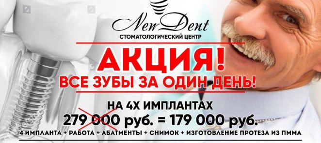 Все Зубы за 1 день