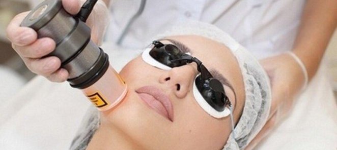 Лазерная биоревитализация Vitalaser лица - 2 490₽