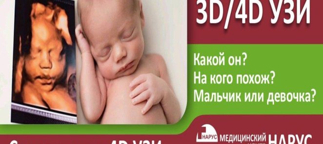 УЗИ 3D/4D