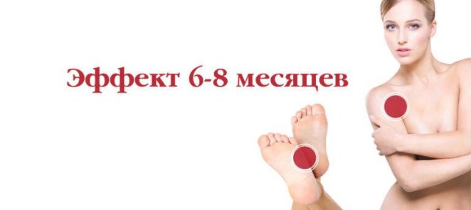 Устранение повышенного выделения пота по специальной цене!