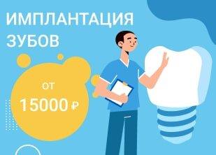 Имплантация зубов от 15000 рублей