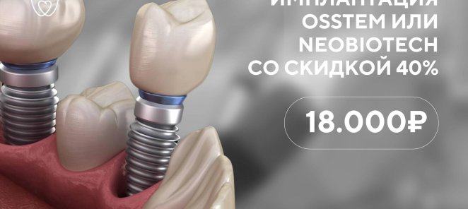 Имплантация Osstem или Neoboiteck со скидкой 40%
