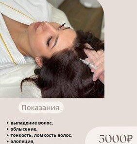 Мезотерапия головы 5000 руб.