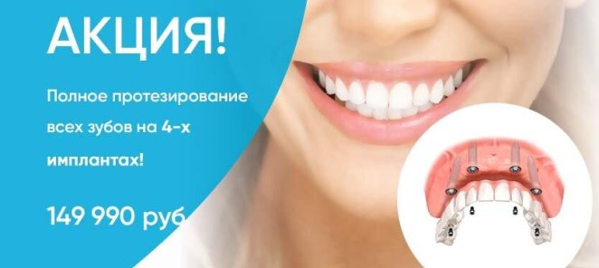 Акция all-on-4!