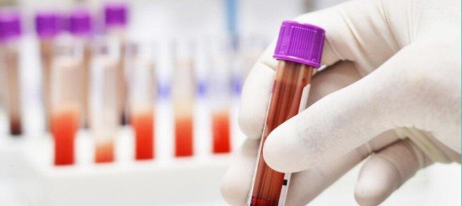-25% на комплекс анализов на возбудителей клещевых инфекций