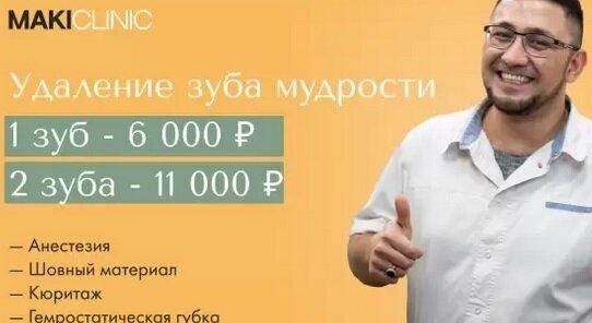 Удаление зуба мудрости со скидкой!