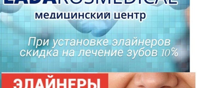 При установке элайнеров экономьте до 10% на лечение!