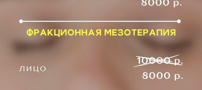 Фракционная мезотерапия абонимент