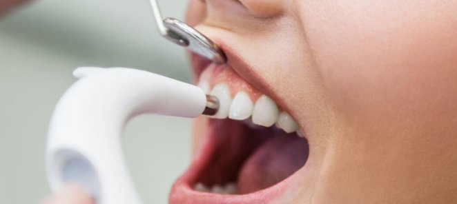 УЗ-чистка, полировка, чистка AirFlow в стоматологии Доктор+