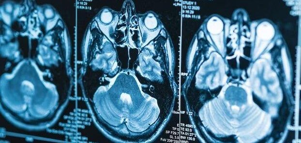 МРТ головного мозга - 4200 ₽