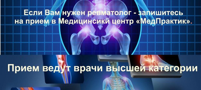 Прием ревматолога