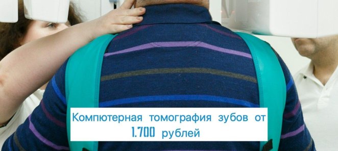 Компютерная Томографи зубов