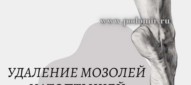 Удаление мозолей и натоптышей 1000-2000р
