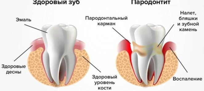 В нашей клинике принимает врач пародонтолог
