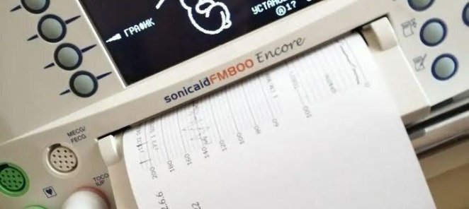 Послушайте и проверьте сердцебиение плода