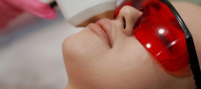 Депиляция верхней губы