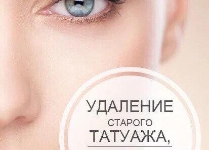 🔥Лазерное удаление татуажа и тату!🔥
