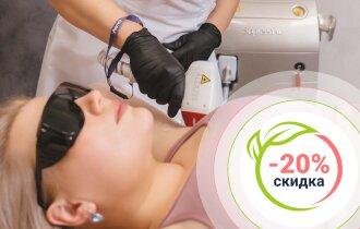 Акция 20% на Лазерную эпиляцию Soprano