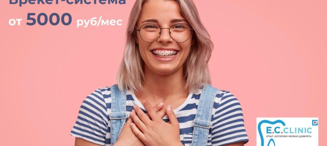 Брекет-система под ключ от 5000 руб./мес!