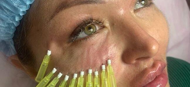 Акция ‼! Мононити скрю 10 шт - 7000₽