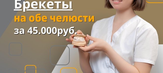 Установка брекет-системы на обе челюсти