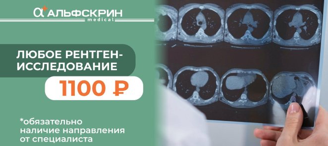 Рентген-исследование за 1100 ₽