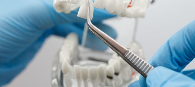 Установка импланта Dentium (Южная Корея) за 28 000 руб.