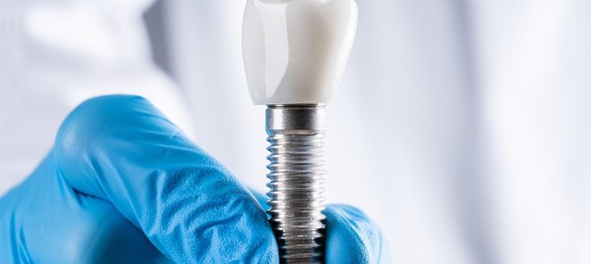 Имплантация под ключ Straumann (Швейцария) 120.000 руб.