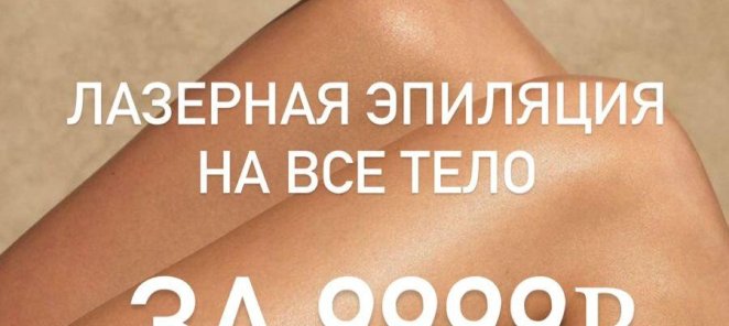 Лазерная эпиляция всего тела Soprano Ice Platinum