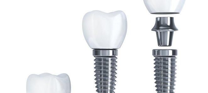 Имплантация Dentium (Южная Корея) 24900 руб.