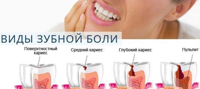 Лучшие цены на лечение зубов по острой боли