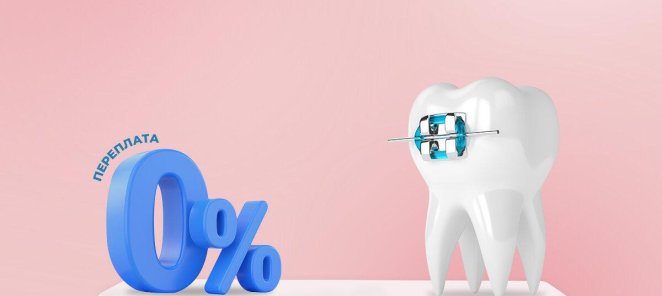 Беспроцентная рассрочка на ортодонтическое лечение