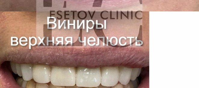 Участникам СВО