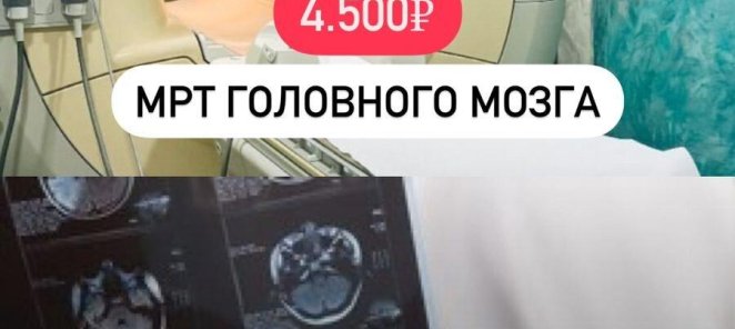 МРТ головного мозга 4500руб+консультация невролога в подарок