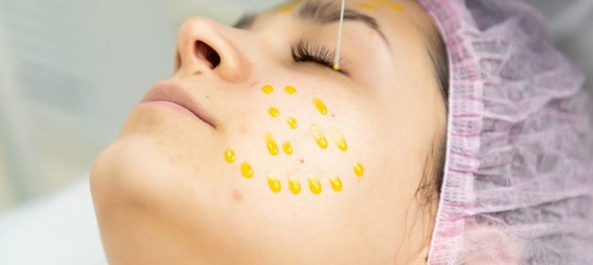 Пилинг Bio Re Peel по вкусной цене