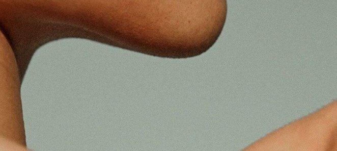Курс 5 процедур Dermadrop + 1 процедуру в подарок