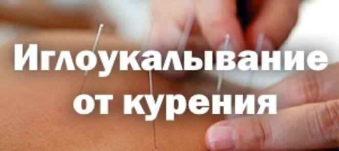 Избавим от курения иглоукалыванием