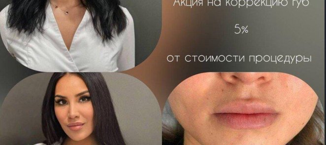 Акция на коррекцию губ