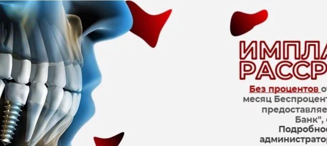 Имплант в рассрочку без процентов от 3000р